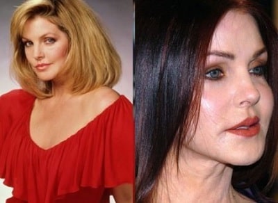 A picture of Priscilla Presley before (left) and after (right).